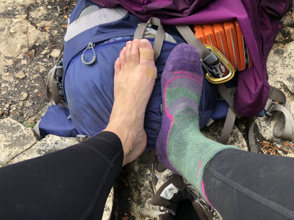 تاول زدن در کوهنوردی | عاشقان طبیعت ایران | عوامل ایجاد و پیشگیری از تاول زدن در کوهنوردی